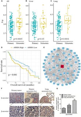 β-Arrestin1 Promotes Colorectal Cancer Metastasis Through GSK-3β/β-Catenin Signaling- Mediated Epithelial-to-Mesenchymal Transition